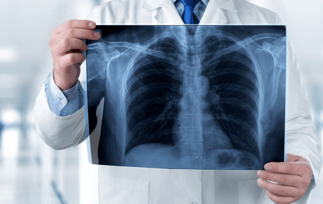 Investigatii imagistice: radiologie și DEXA