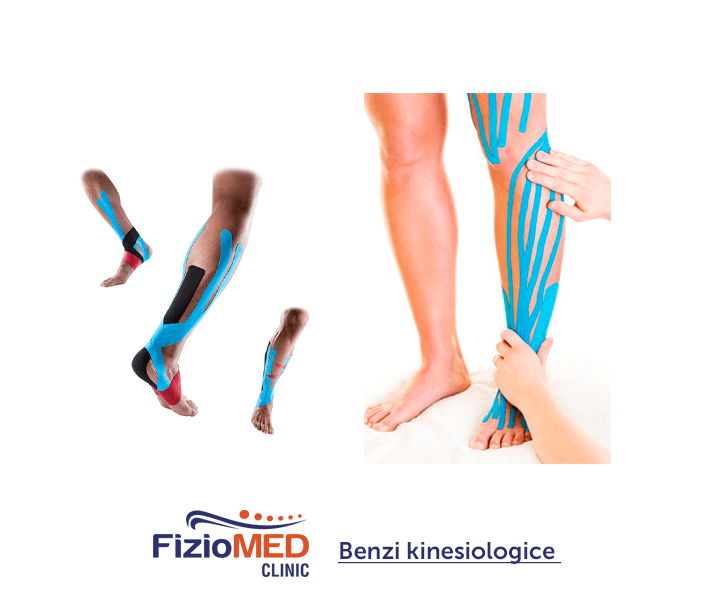 Nou la FizioMED Suceava – benzile kinesiologice