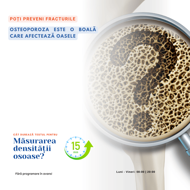 Osteodensitometrie DEXA