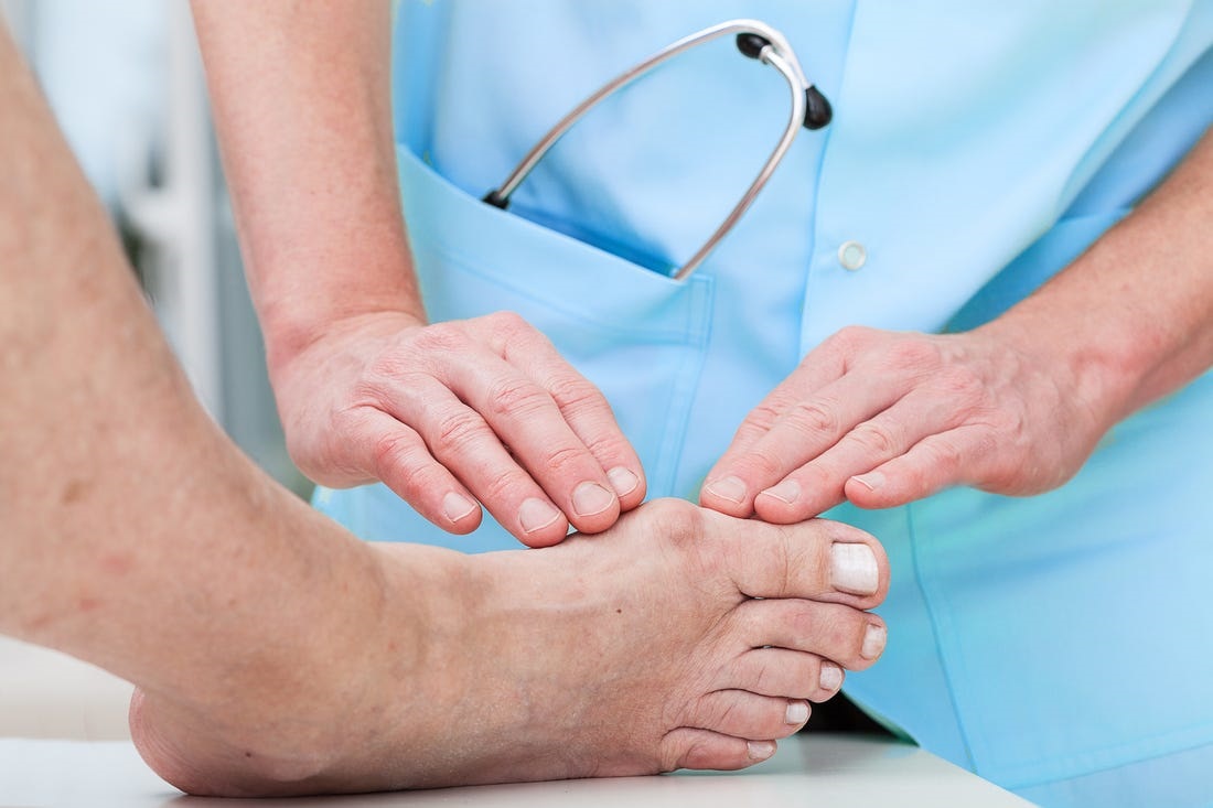 Guta: simptome, cauze, preventie si tratament