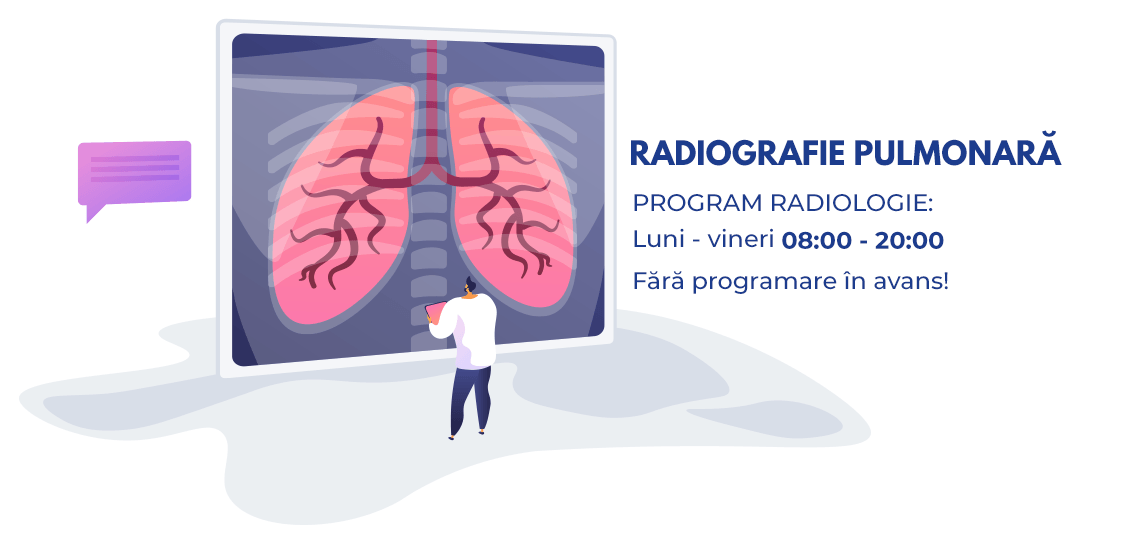 Radiografia pulmonara | Cand este indicata si de ce
