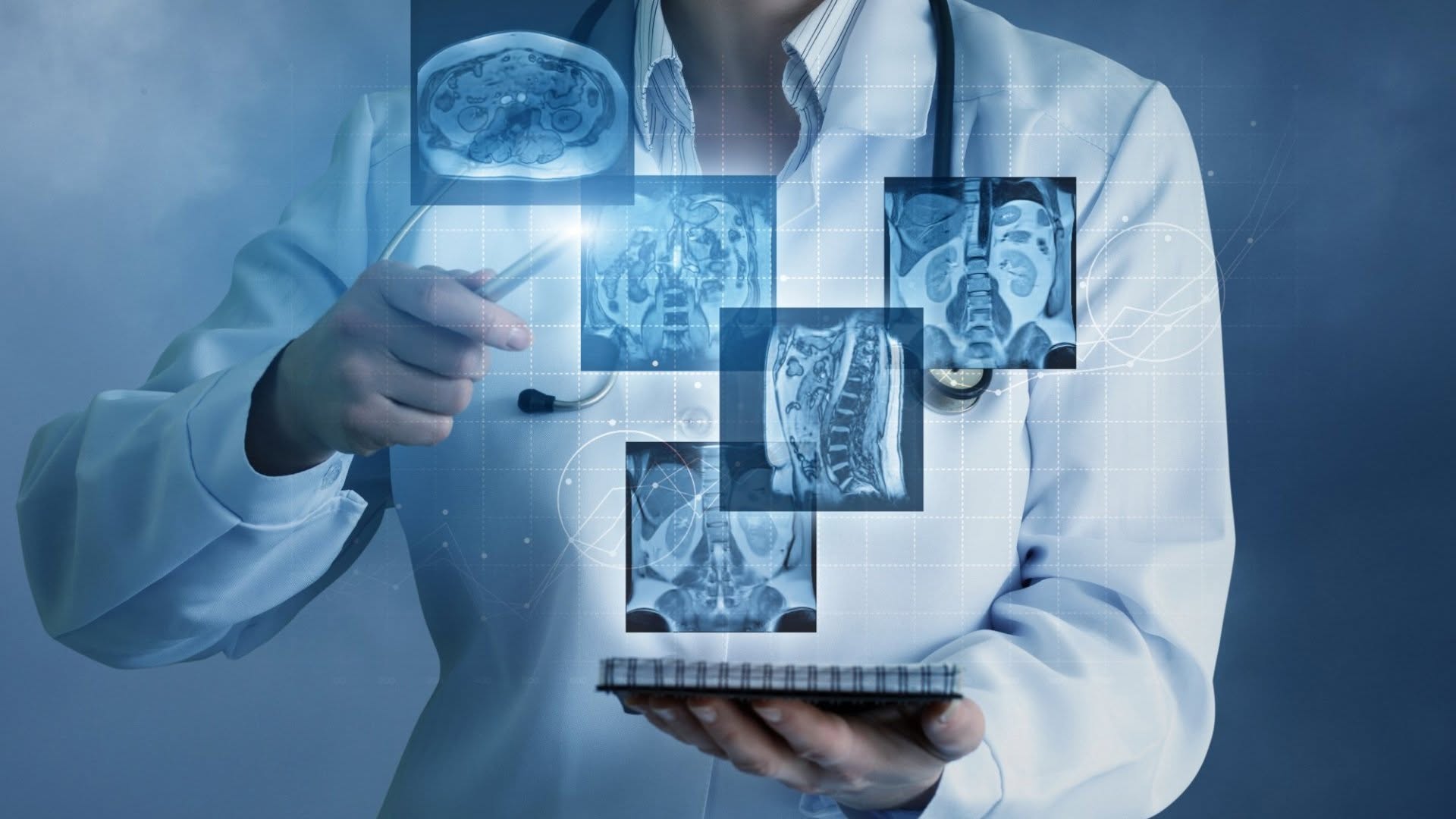 Radiografie digitală de înaltă rezoluție